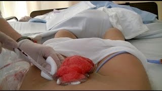 Lost Footage Of SRS Recovery *GRAPHIC*