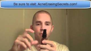 Apple Cider Vinegar - Acne Treatment?