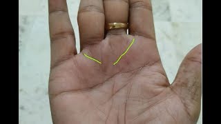 Partial Girdle of Venus in Male Hand