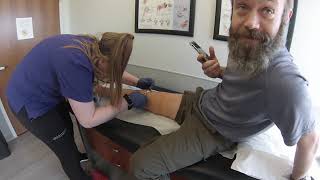Patellar Fracture Update: 10 Days Postop