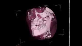 Конусно-лучевой компьютерный 3D томограф SkyView
