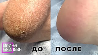 СЕКРЕТ идеального педикюра ? ЧТО и КАК???