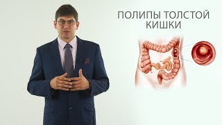 полипы толстой кишки (полип анального канала, полип прямой кишки)