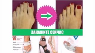 Средство от шишек на больших пальцах ног