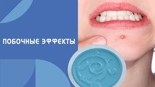 Побочные эффекты. Катушки Мишина (вихревая медицина)
