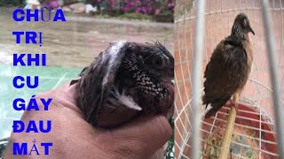 Hướng Dẫn Chữa Trị  Khi Cu Gáy Bị Đau Mắt