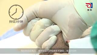 LangHe Circumcision - Disposable Circumcision Suture Device - 2nd generation