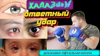 Халазион - Ответный удар