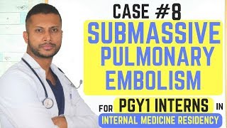 Submassive Pulmonary Embolism - Internal Medicine Residency Series