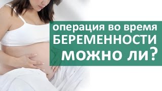 Операция при беременности. Безопасно ли делать операцию во время беременности?Членкор РАН О. Луцевич