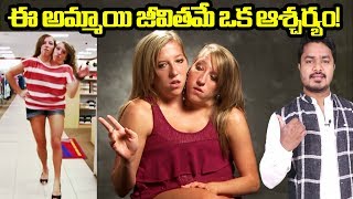 Story of Strange Girls | Conjoined Twins | Abigail & Brittany Hensel | VikramAditya | EP#169