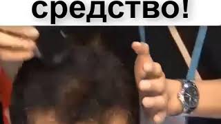 биотин от выпадения волос отзывы