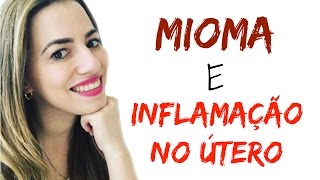 Alimento PODEROSO para Combater MIOMA e INFLAMAÇÃO NO ÚTERO | Mundo de Mariana