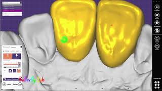 Design EXOCAD Modelling Коронки из диоксида циркония