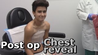 Post op chest reveal Dr. Garramone