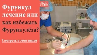 Фурункул лечение и как избежать Фурункулеза? Смотрите в этом видео