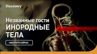 Незваные гости | Инородные тела | Discovery