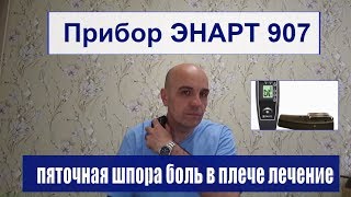 Пяточная шпора и боль в плече Быстрое лечение прибором Энарт 907