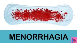 Heavy Menstrual Bleeding: causes, diagnosis and treatment.