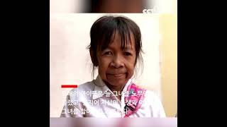캄보디아 10살 어린 소녀, 지방 대사 희귀 장애증에 걸려 | CCTV 한국어방송