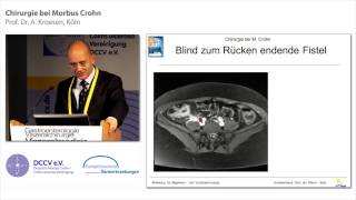 Chirurgie bei Morbus Crohn