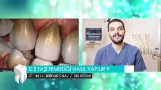 Diş Taşı temizliği nasıl yapılır? - Dt. Hakkı Serdar Ünal