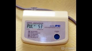 Ремонт тонометра AND UA702 включается через раз.