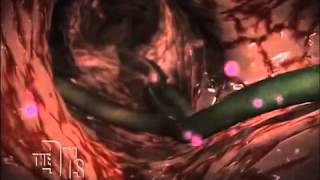 What Happens To Your Stomach When Overeating On Thanksgiving