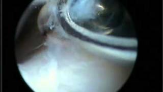 SVIDEO 0727 123158
