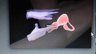bimanual pelvic examination 2