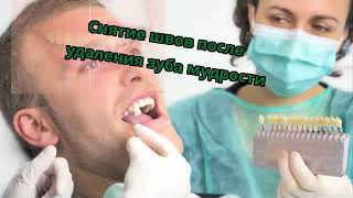 Снятие швов после удаления зуба мудрости