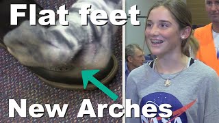 FLAT FOOTED teenage GIRL instantly  GETS ARCHES by faith in Jesus
