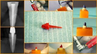 How to make custom made post and core - for dental stu sents