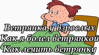 Ветрянка у взрослых, как лечить. Как я заболел ветрянкой