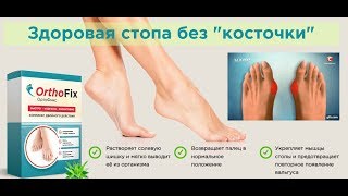 Orthofix купить в Новосибирске