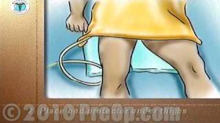 Perineal Wash Female Surgery PreOp® Patient Education PostCare