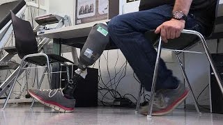 Une prothèse "sensible" pour changer le quotidien des amputés