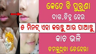 Remove Pimples & Acne and Their Marks In Just 1 Day | Skin Whitening Pack | | Priyanka's Tips