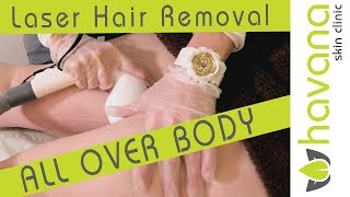 Laser hair removal all over body at Havana Skin Clinic