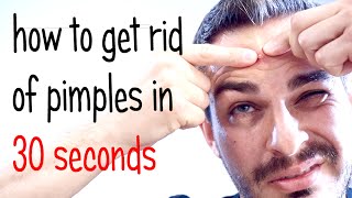 Get rid of pimples or acne in 30 seconds - Men's Fashion