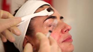 FILORGA - Bespoke NCTF 135 for Mesotherapy For Total Turnaround Results
