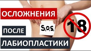 ❗️?ОСЛОЖНЕНИЯ ПОСЛЕ ЛАБИОПЛАСТИКИ  ❗️?ТОЛЬКО 18+