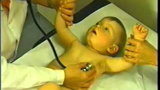 SEMIOLOGIA PEDIATRICA 2 - A LOS NUEVE MESES - 2054