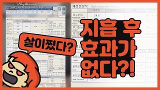 [바이원클리닉] 지방흡입 하고 효과가 없다? 지방흡입의 효과부터 효과적인 운동법까지 알아보자!