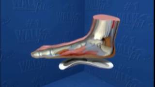 Walkfit Platinum - Teleshopping.