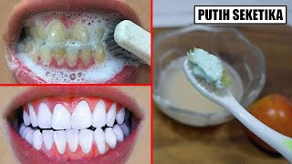 RESEP PATEN! KARANG GIGI RONTOK, GIGI KUNING PUTIH KEMBALI DALAM WAKTU SINGKAT 