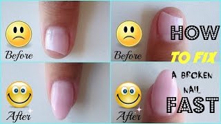 How to Repair a Broken Gel Nail FAST