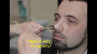 Фурункул в носу  Лечение фурункула носа народными средствами и методами