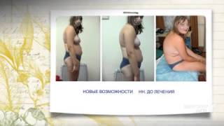 корректор осанки для взрослых