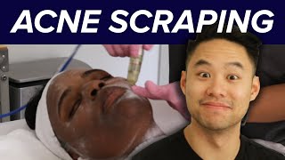We Scraped The Acne Off Our Faces